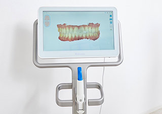 ｢iTero｣で矯正治療の精度が高まる理由