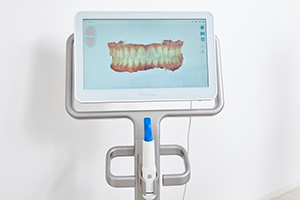 口腔内スキャナー